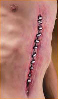 Reel F/X Malpractice Prosthetic - Rubies Costumes & Accessories - HalloweenCostumes4U.com - Accessories