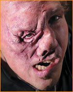 Reel F/X Igor Prosthetic - Rubies Costumes & Accessories - HalloweenCostumes4U.com - Accessories